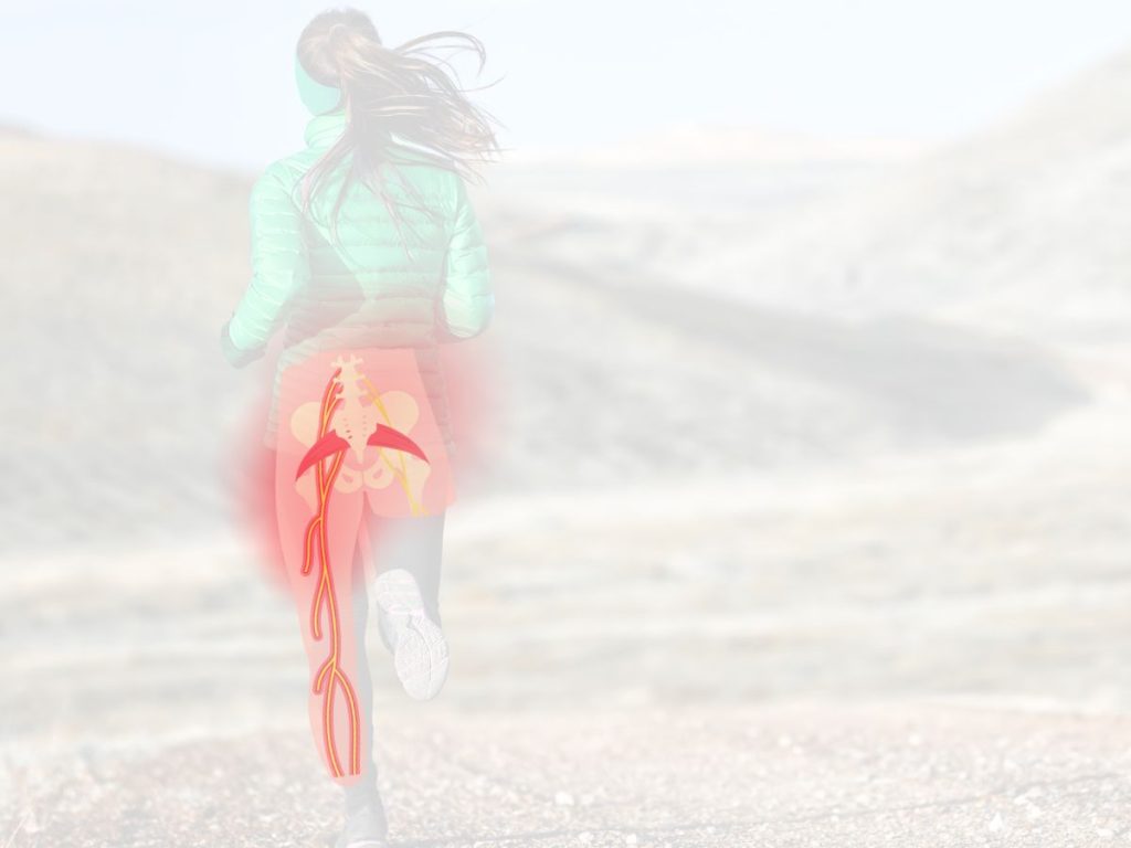 Sciatica nerves in a runner
